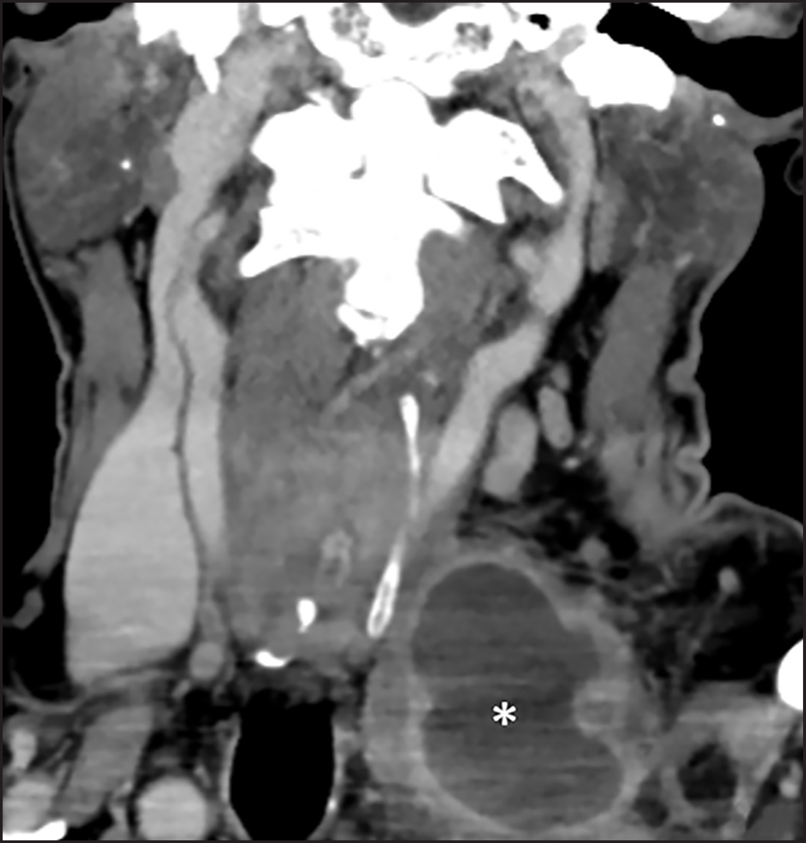 FIGURE 11.