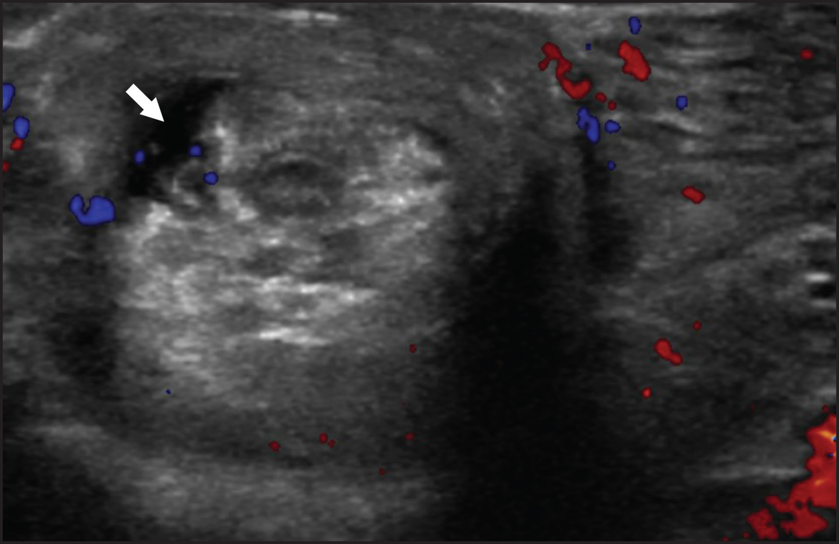 FIGURE 7.