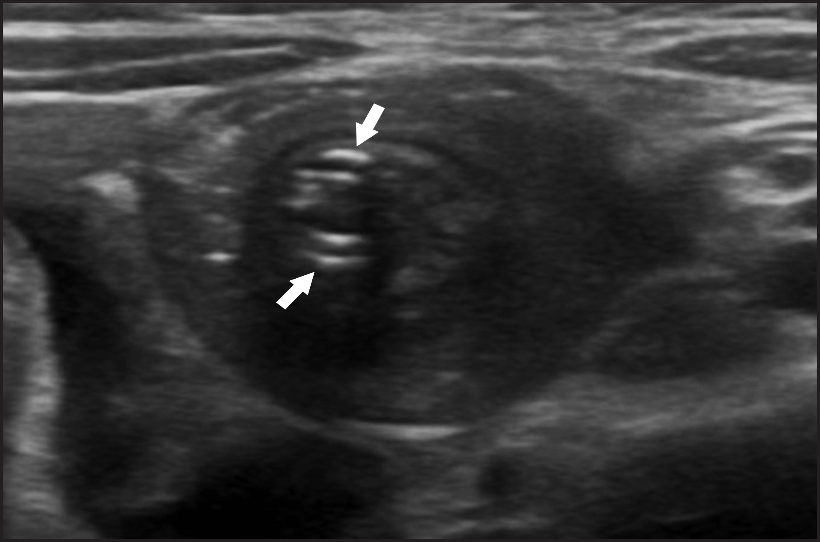 FIGURE 11.