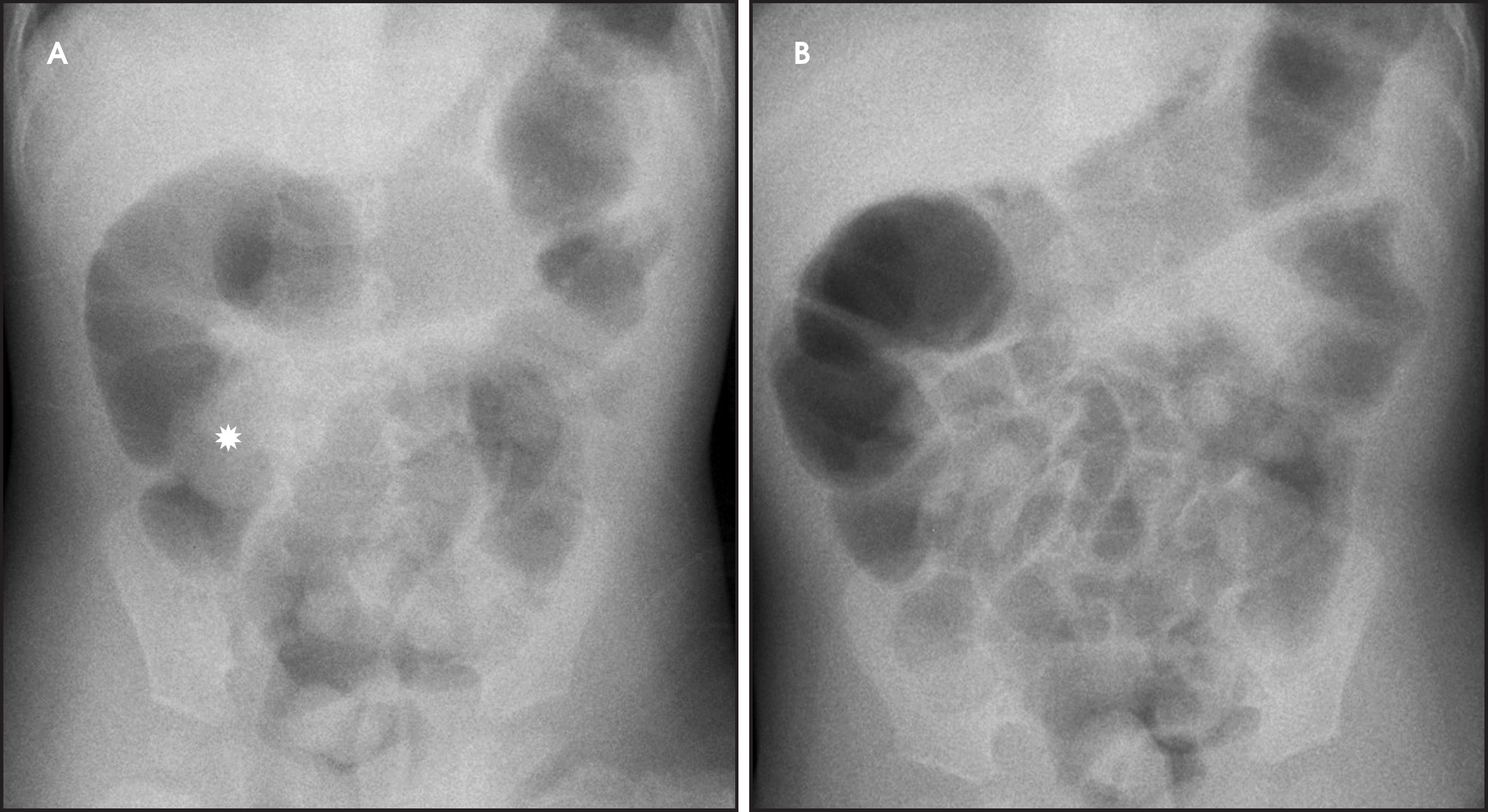 FIGURE 13.