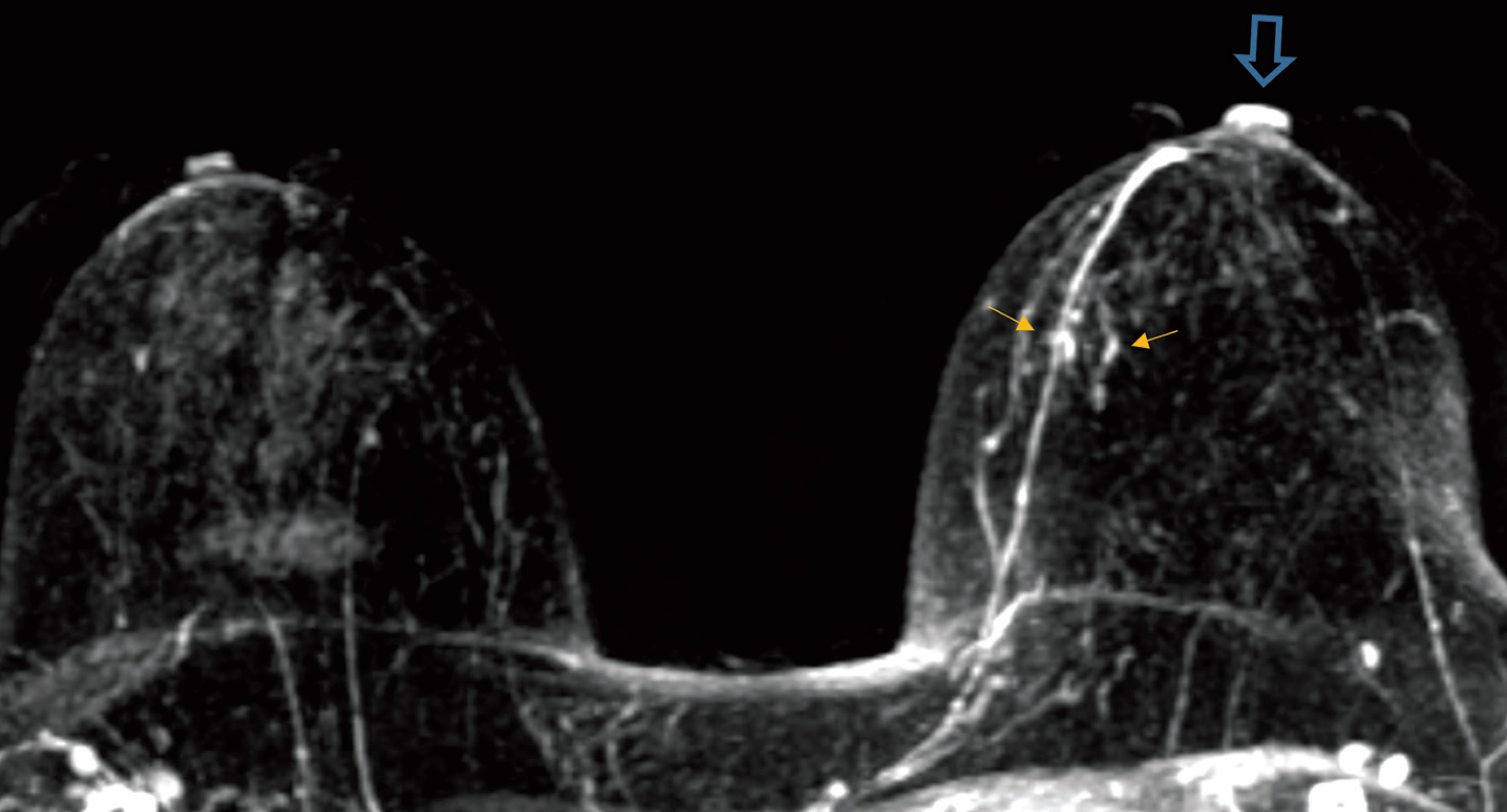 FIGURE 9.