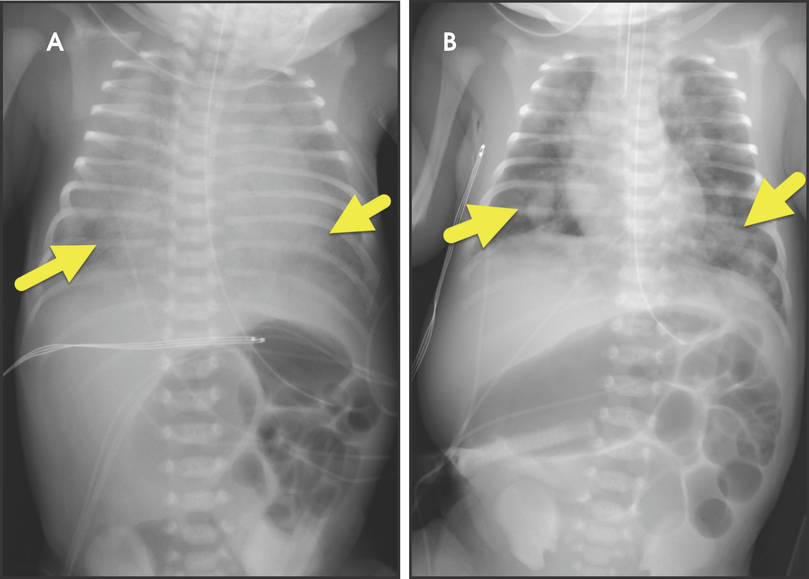 FIGURE 4.