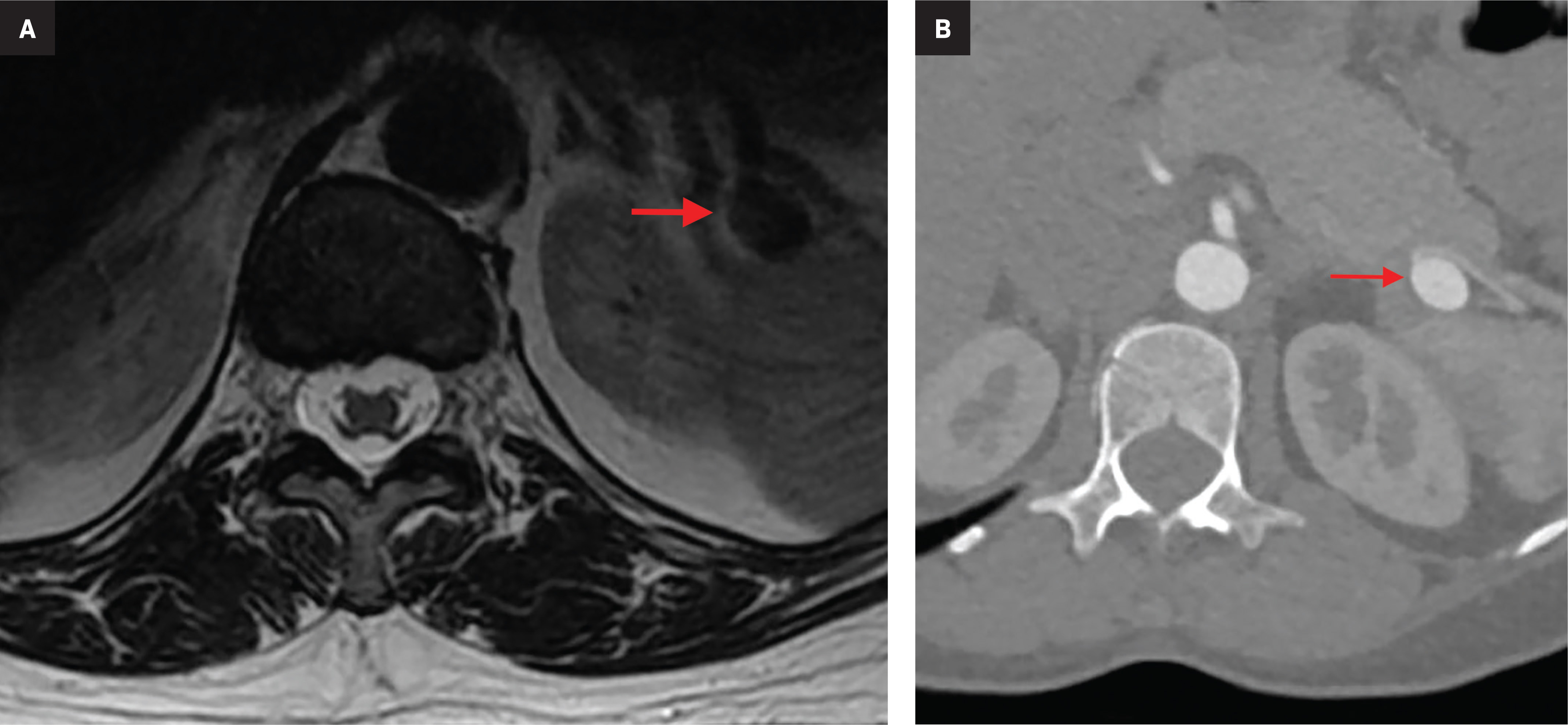 Figure 11.