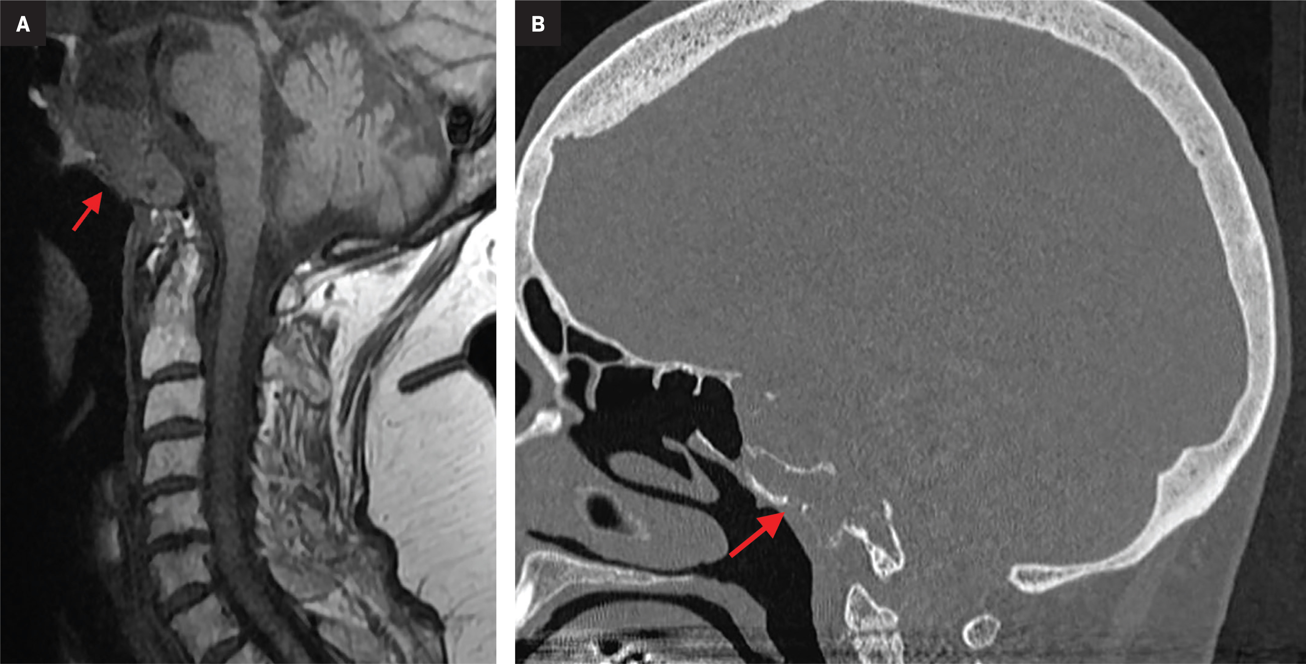 Figure 12.