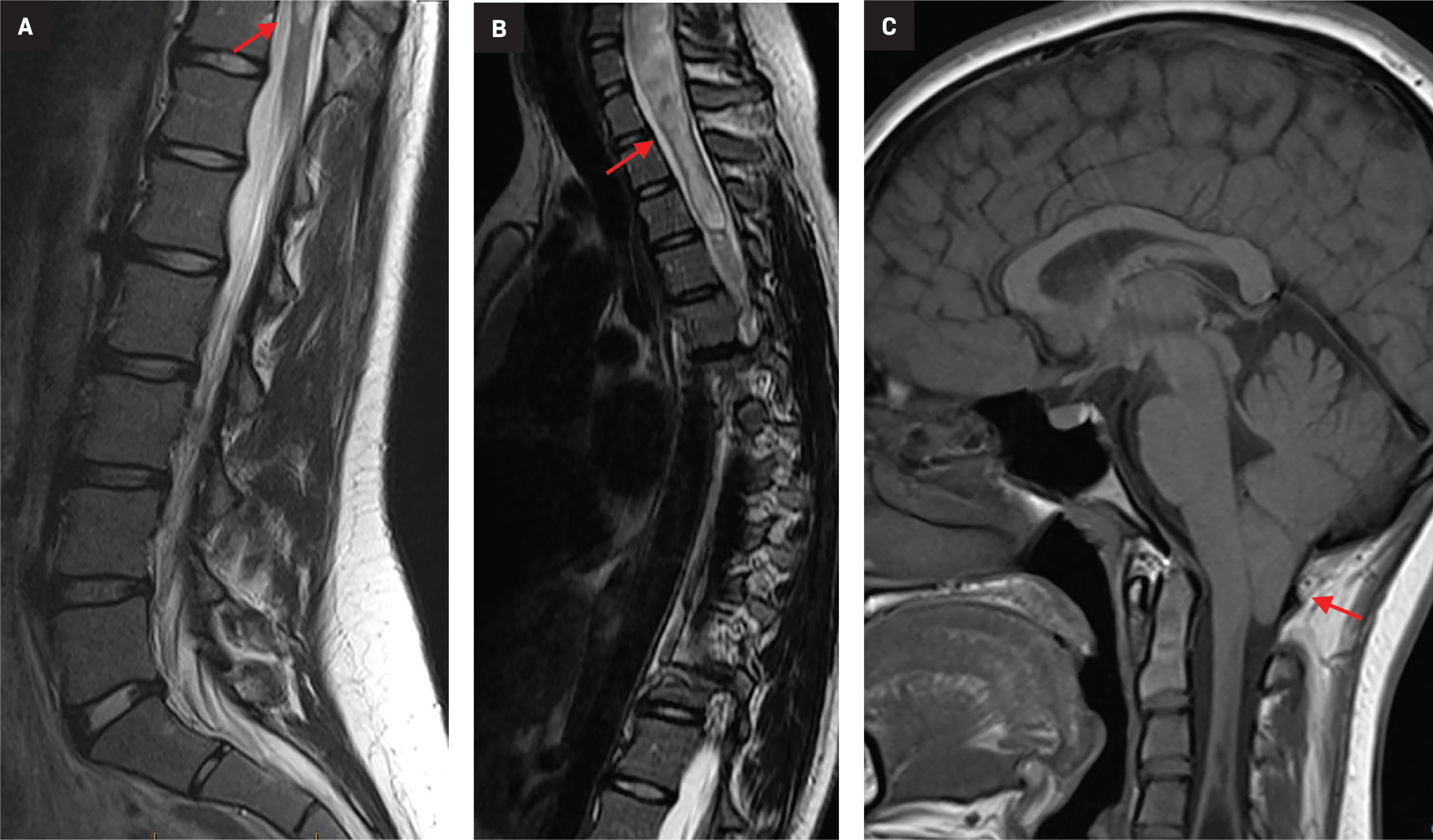 Figure 14.
