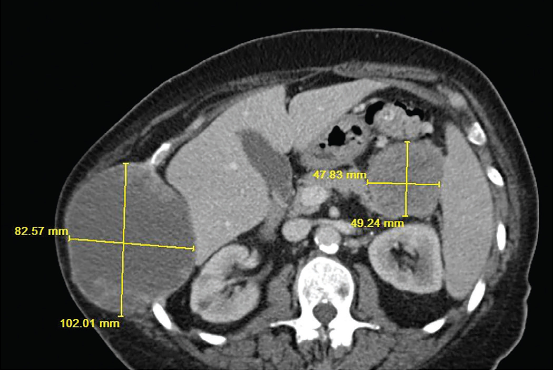 Figure 2.