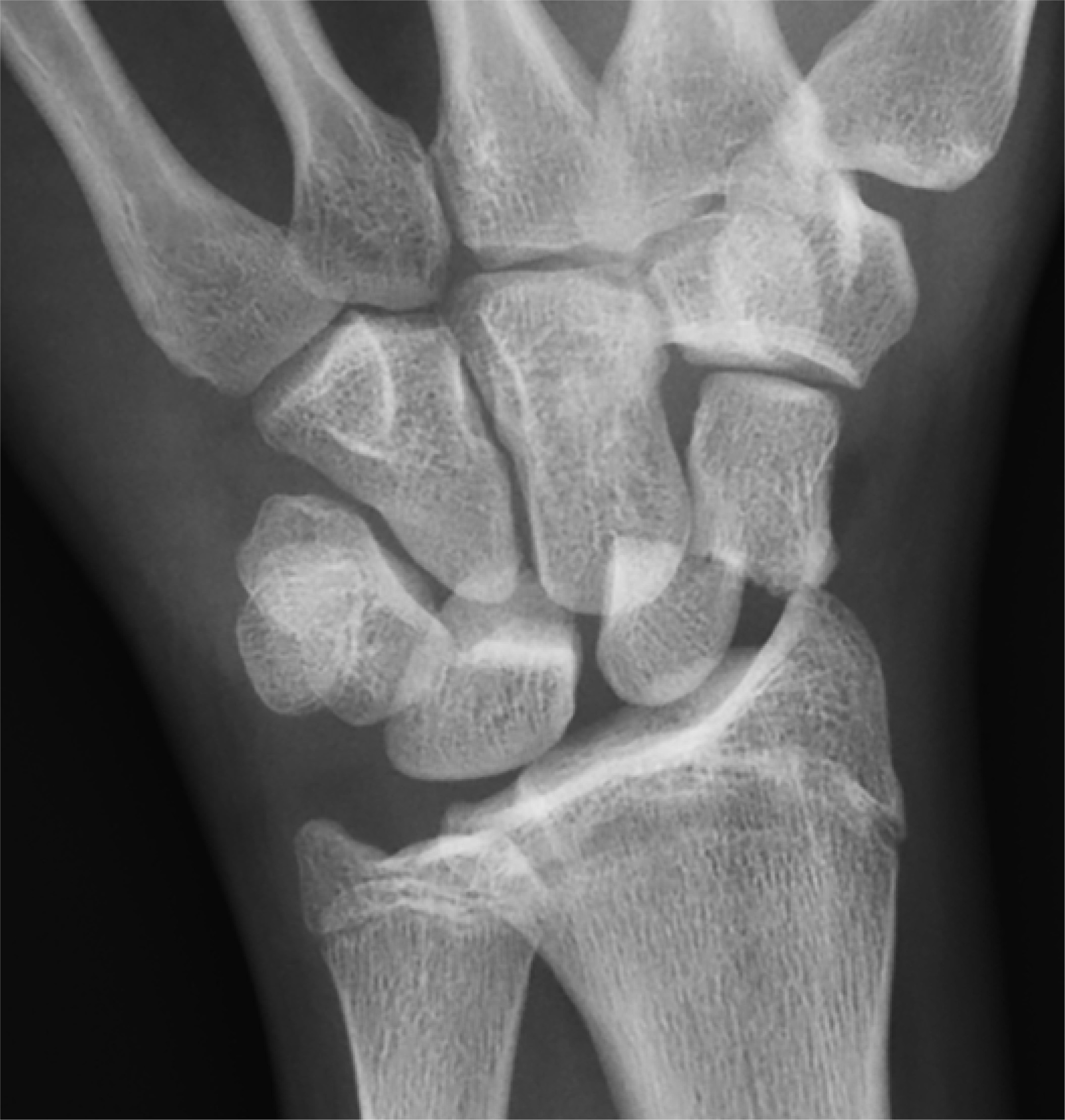 Figure 11.