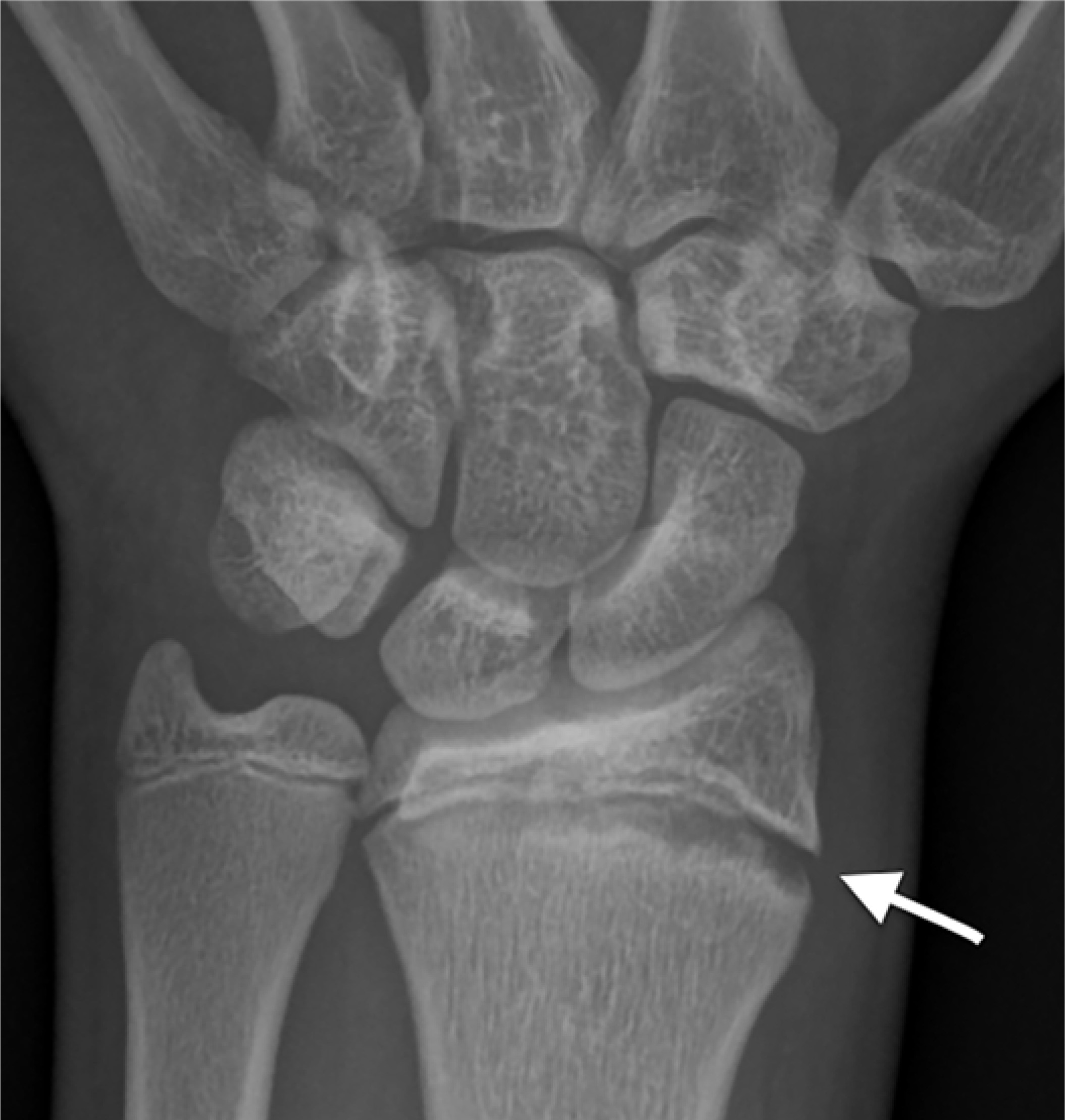 Figure 12.