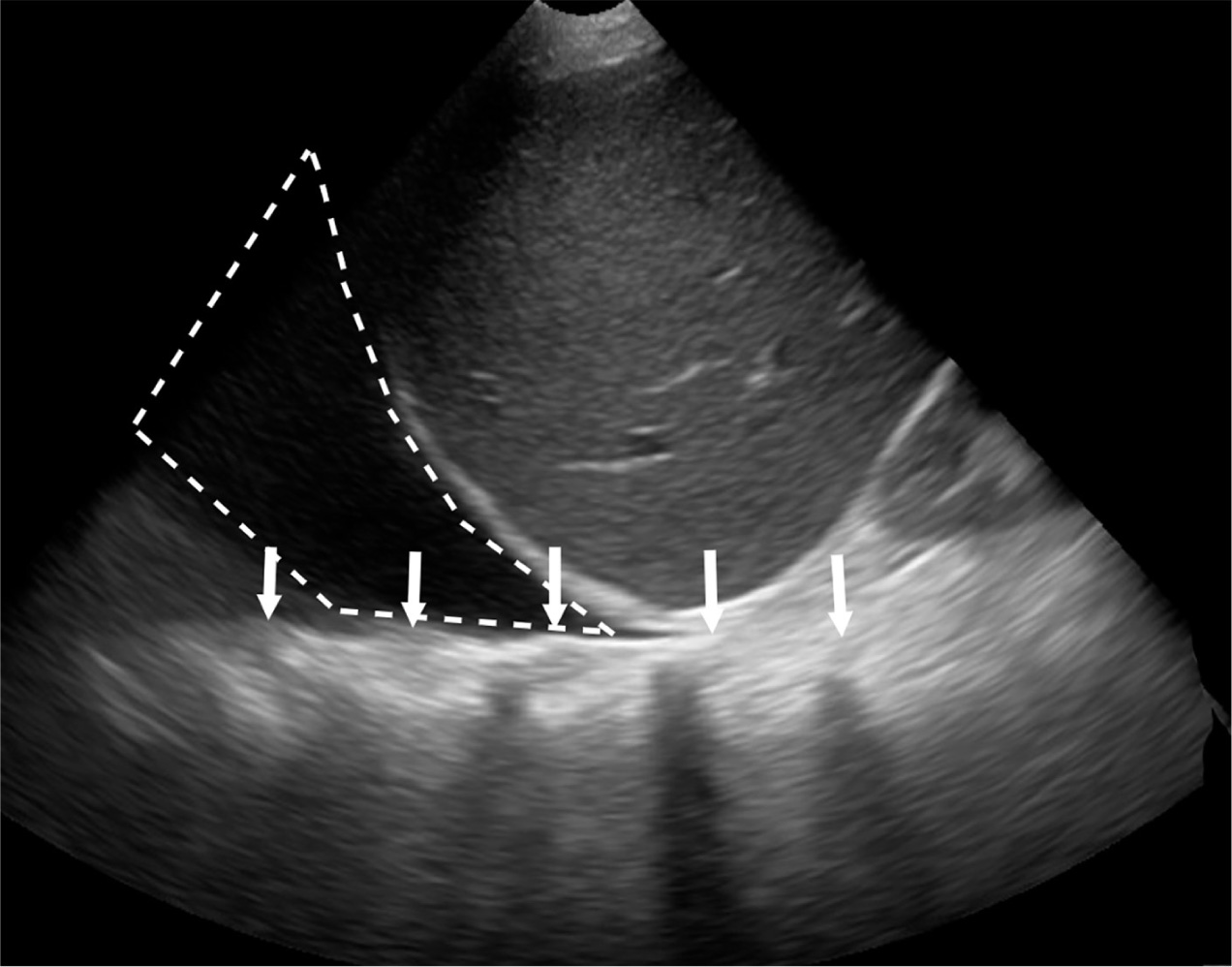 Figure 14