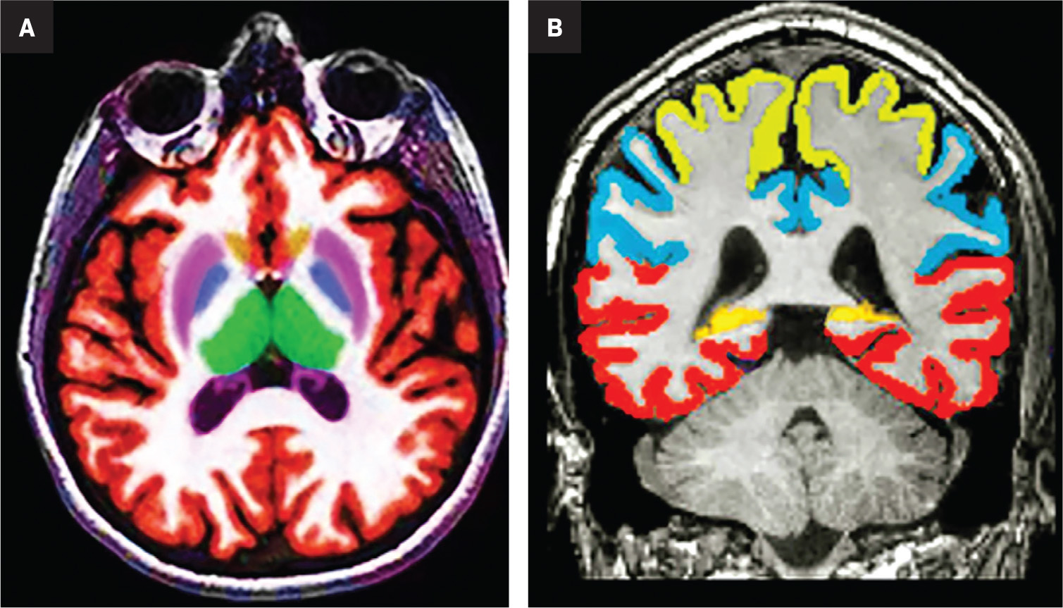Figure 11