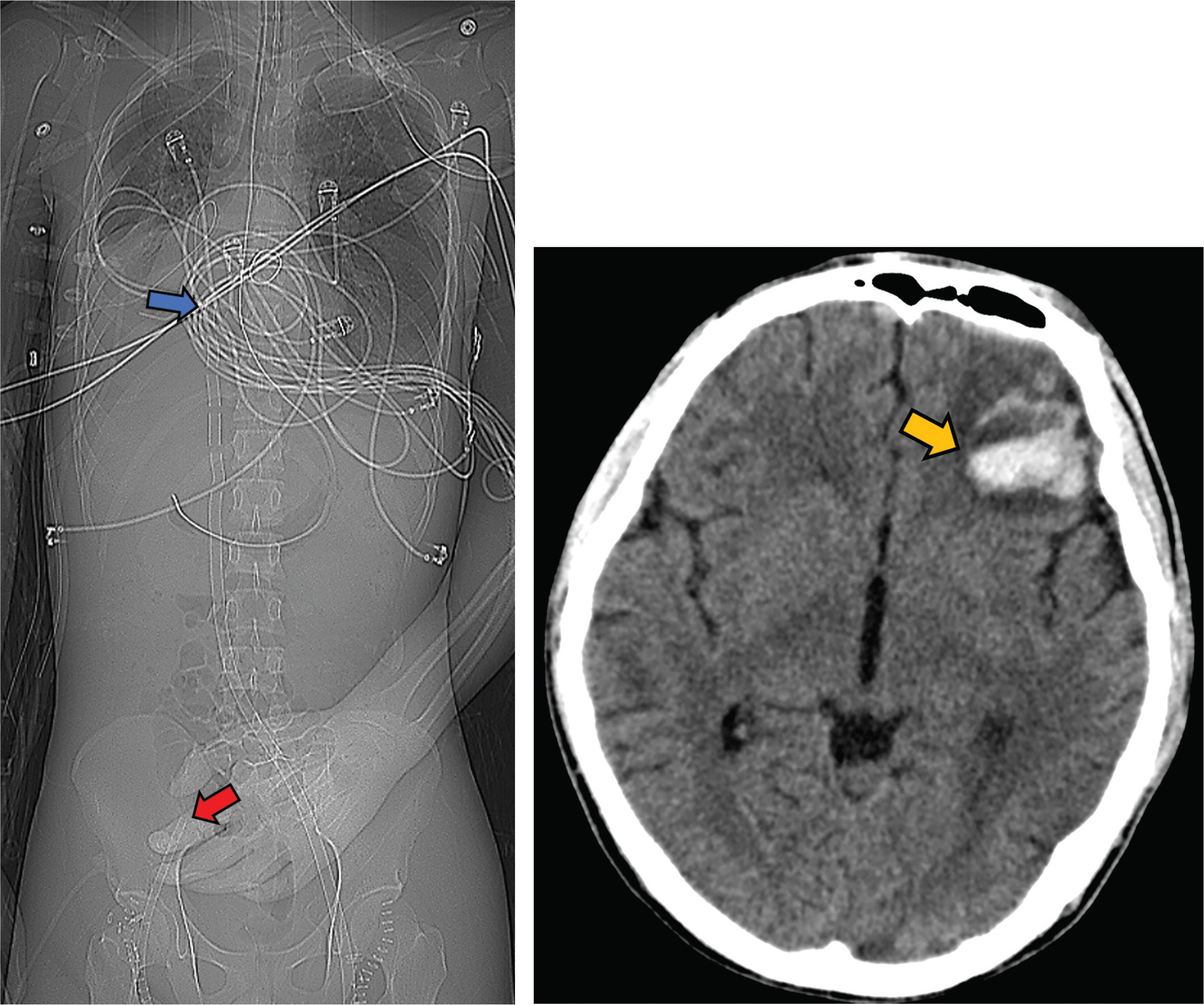 Figure 11