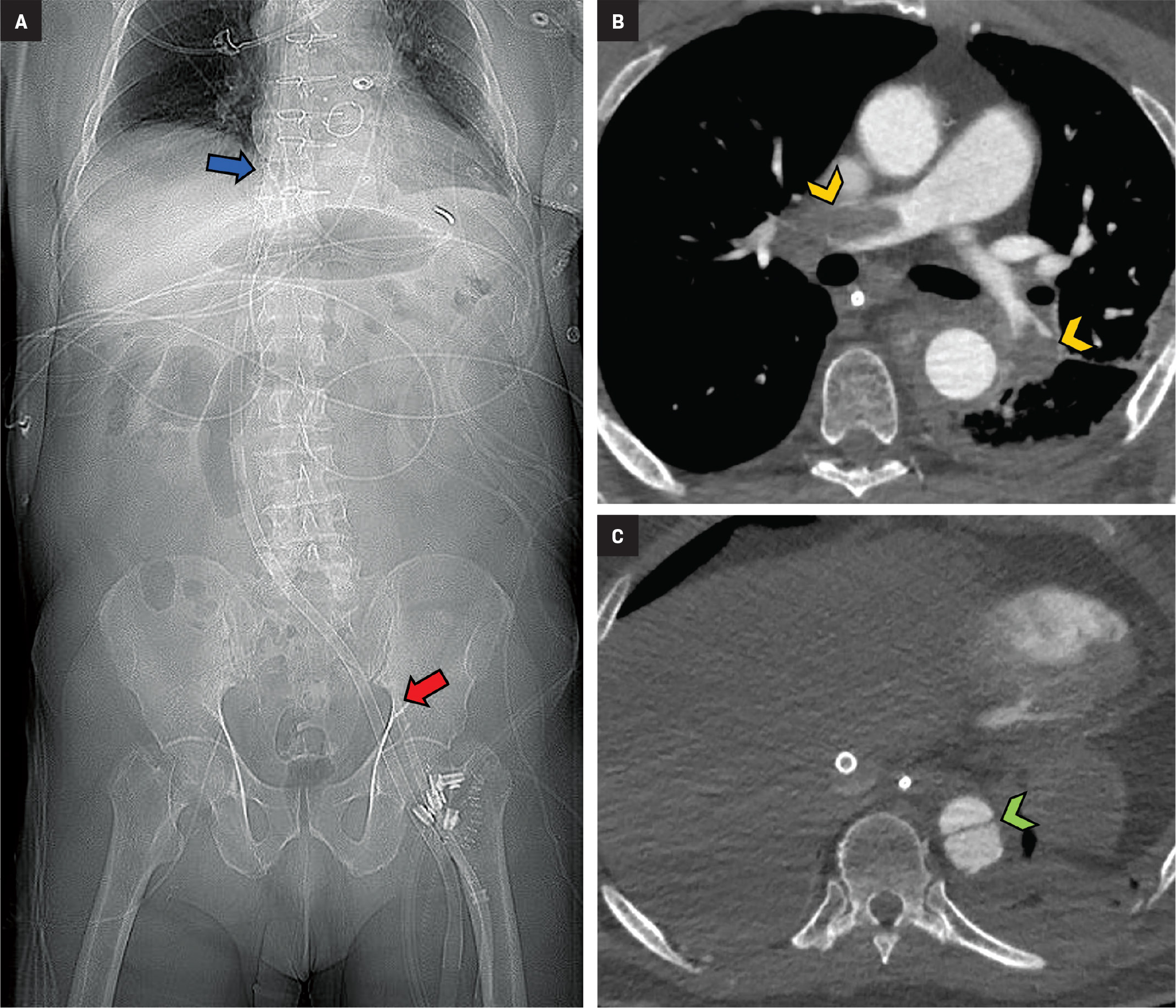 Figure 12