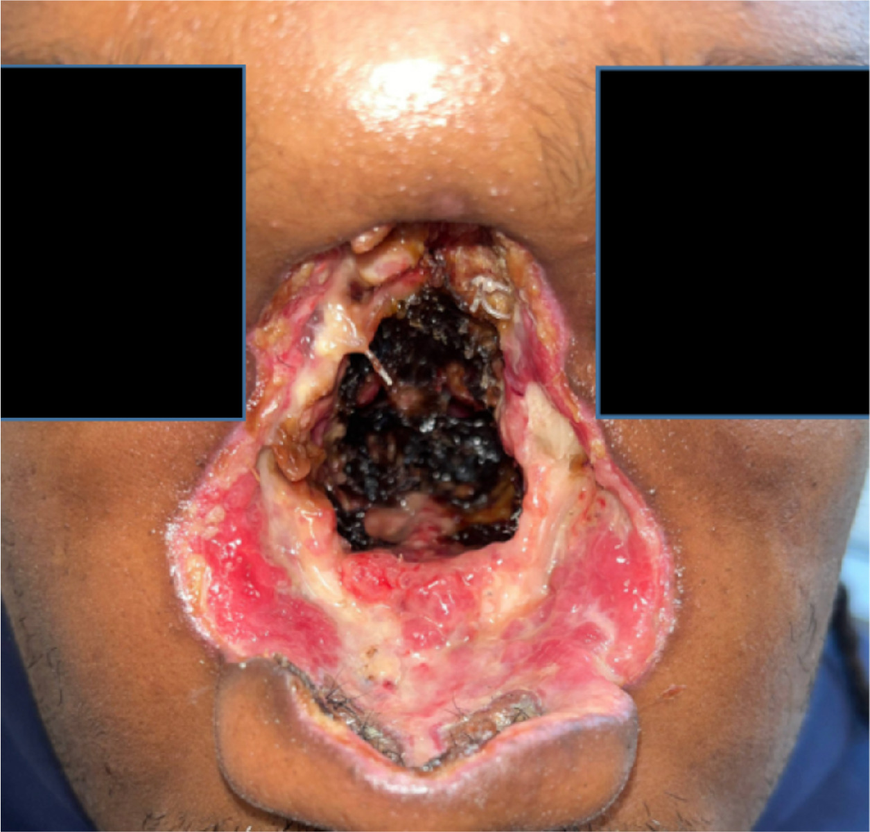 Clinical patient image after surgery.