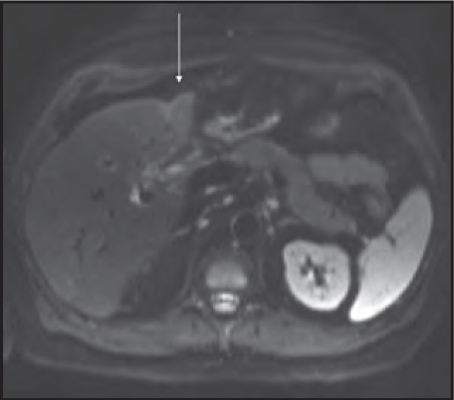 FIGURE 9.