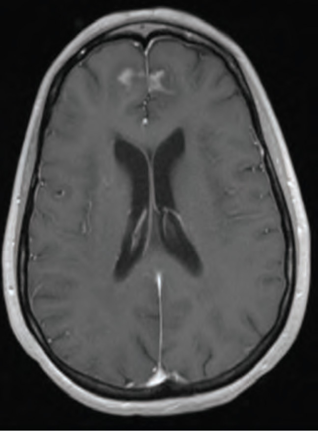 FIGURE 4.
