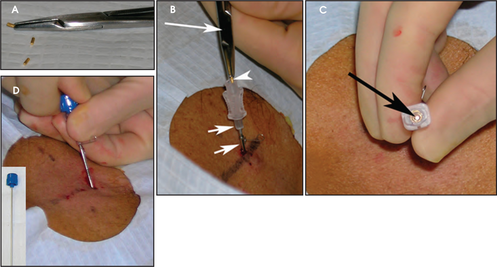 FIGURE 11.