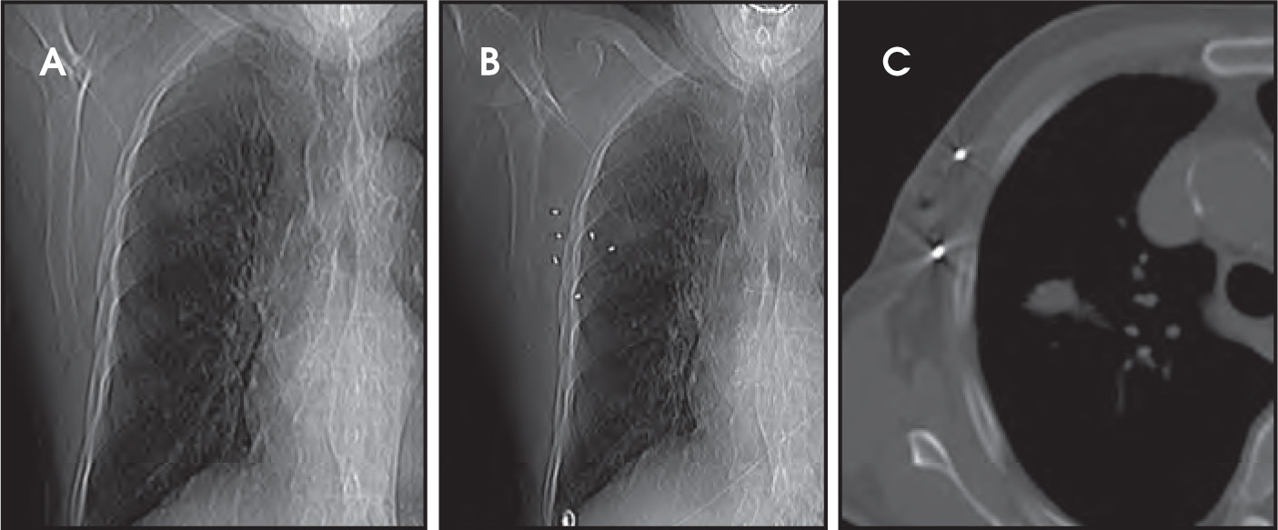 FIGURE 12.