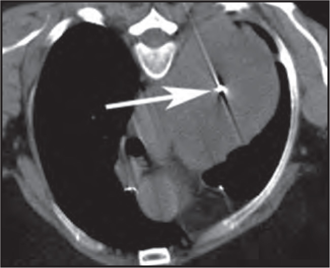 FIGURE 13.