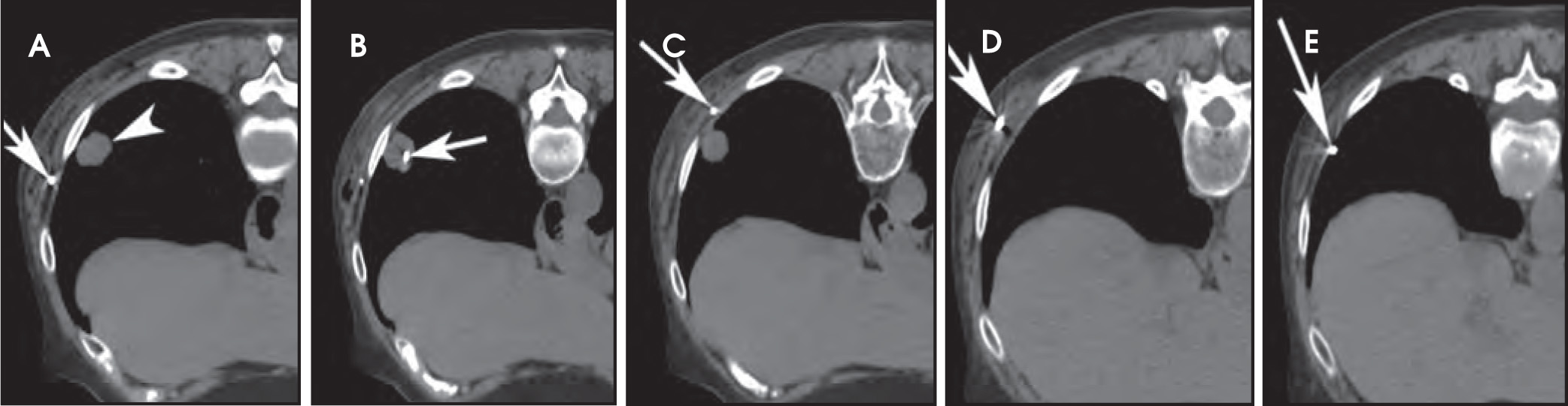 FIGURE 14.