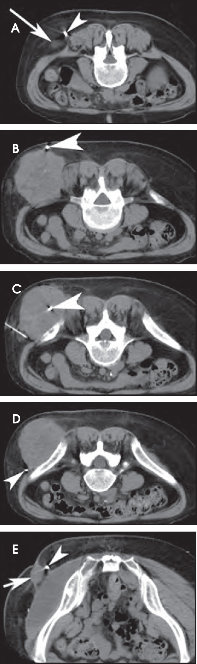 FIGURE 16.