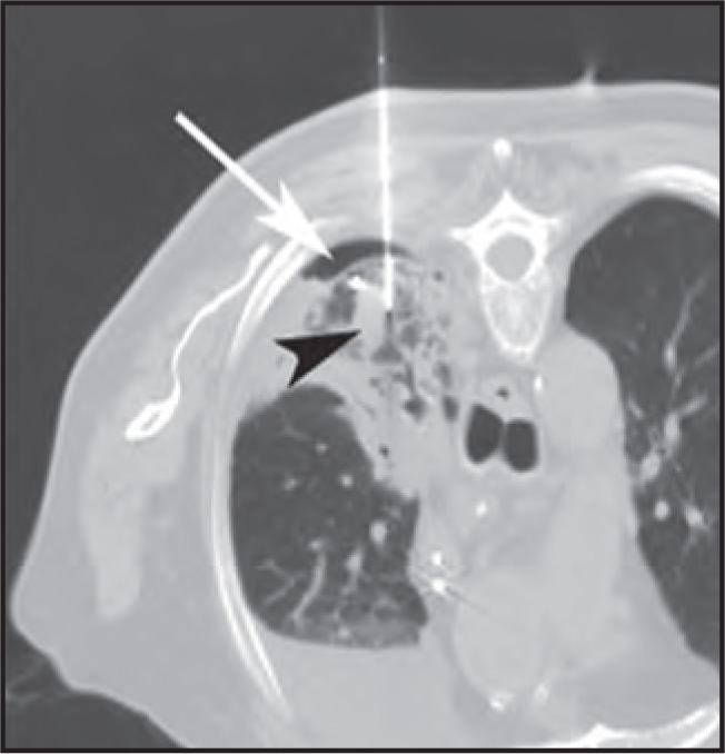 FIGURE 17.