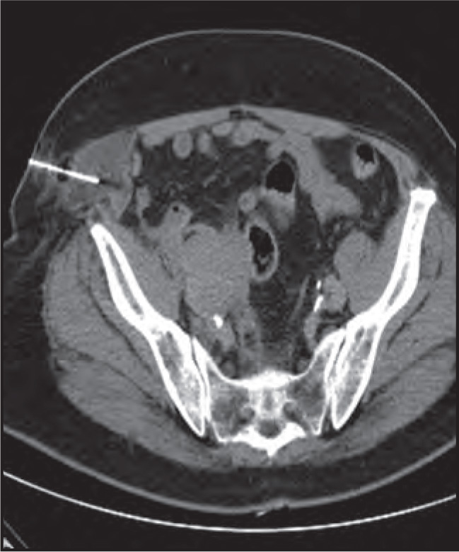 FIGURE 18.