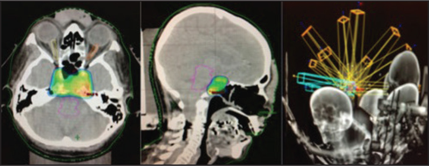 FIGURE 2.