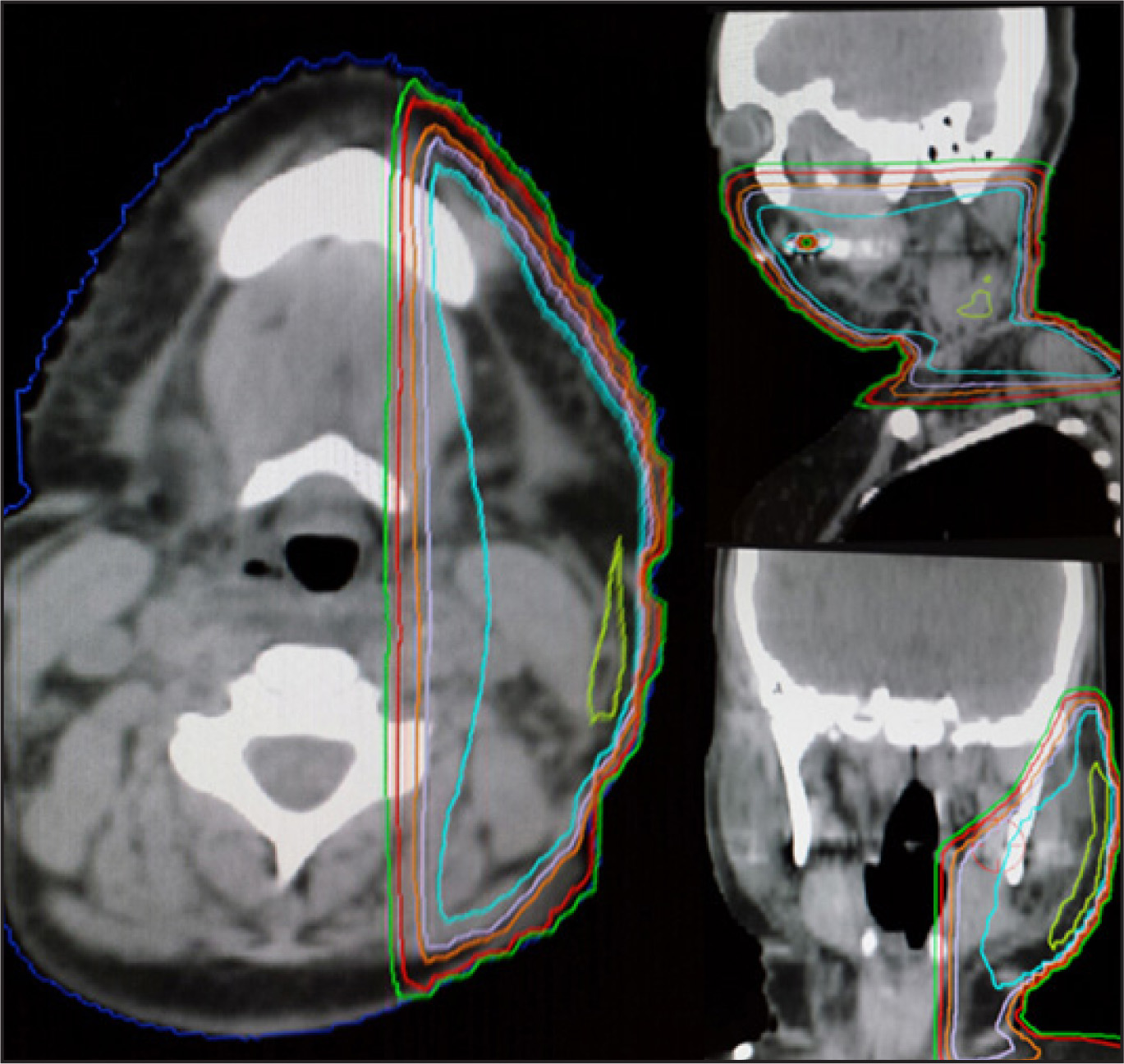 FIGURE 1.