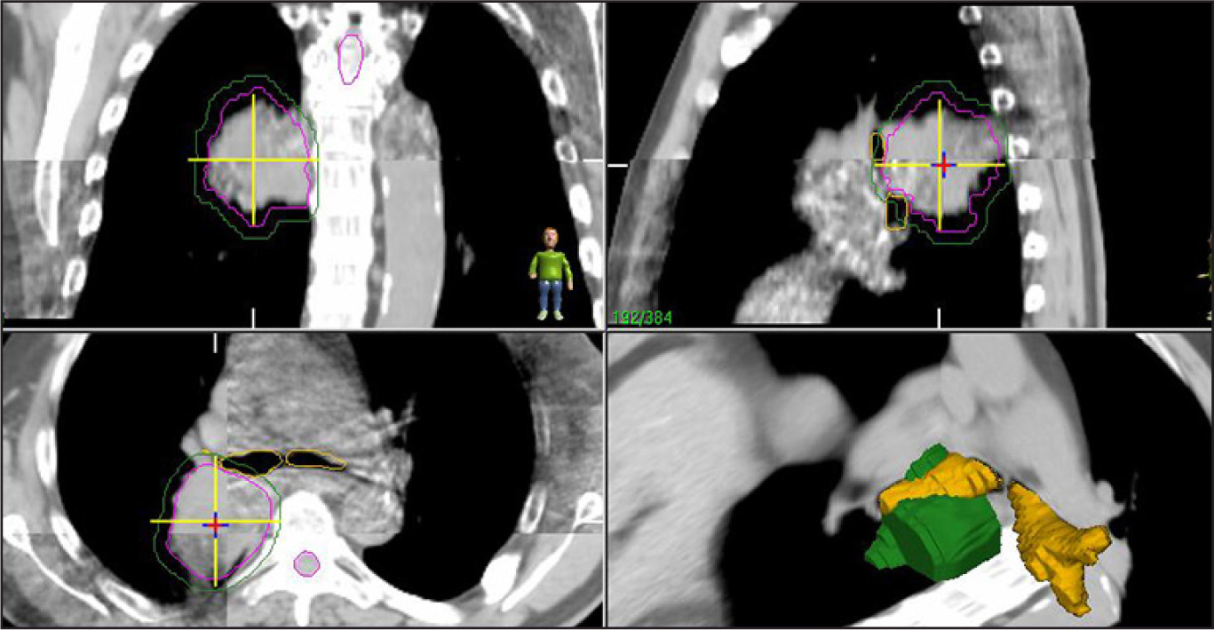 FIGURE 4.