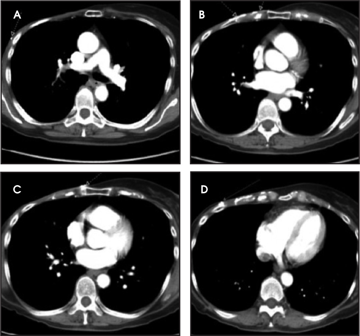 FIGURE 2.