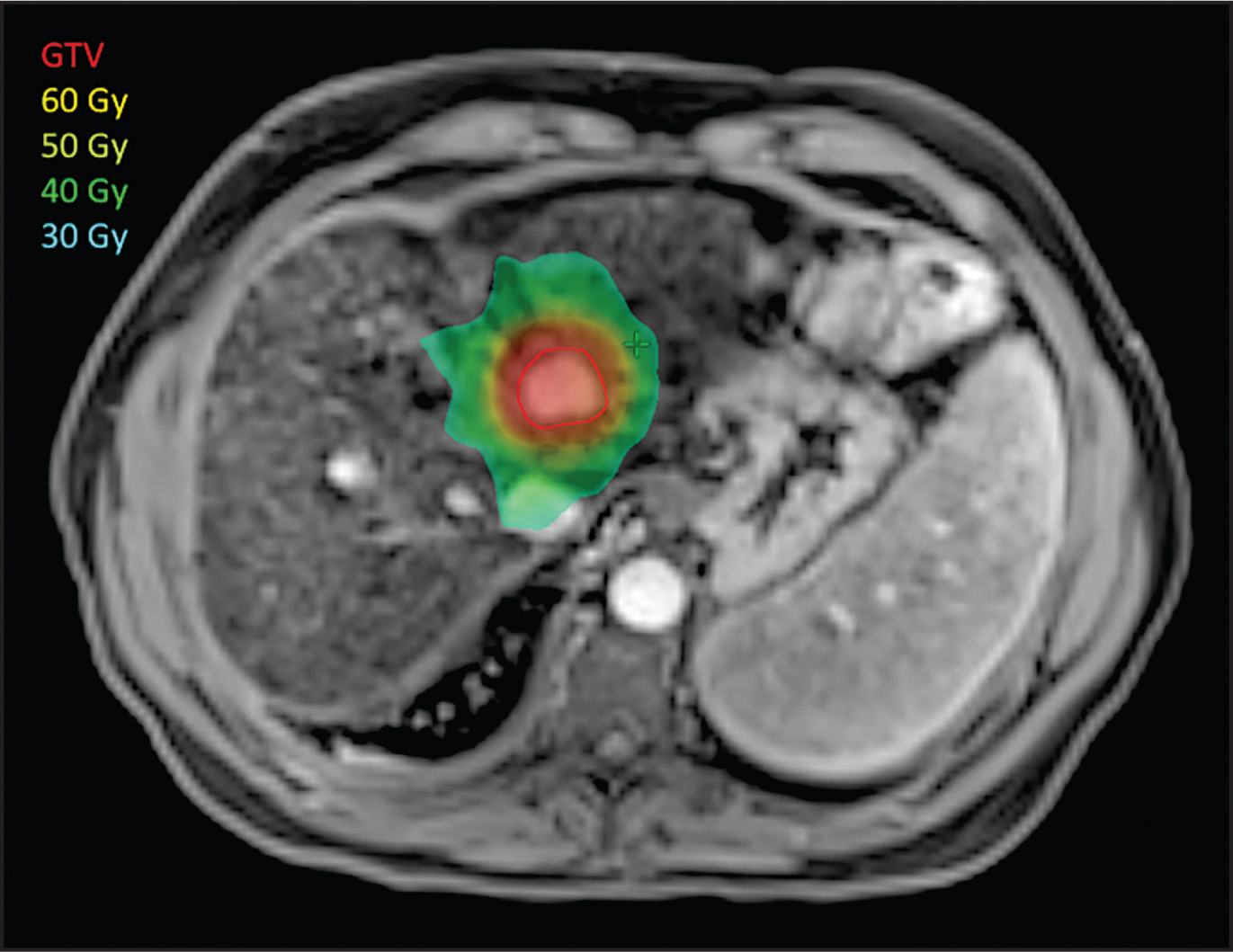 FIGURE 1.