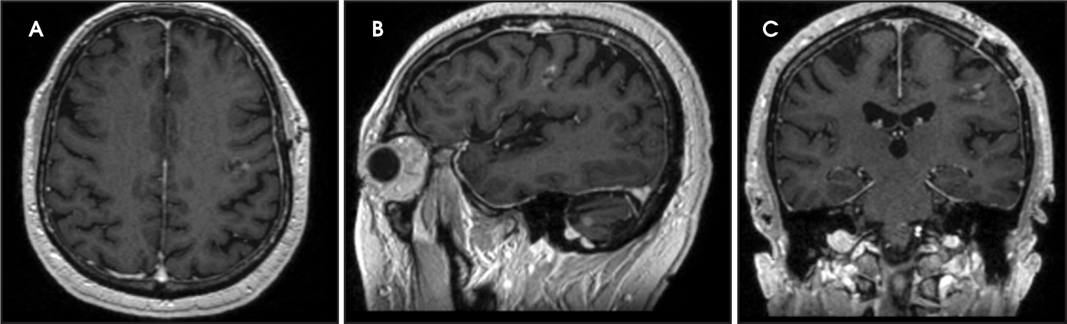 FIGURE 3.