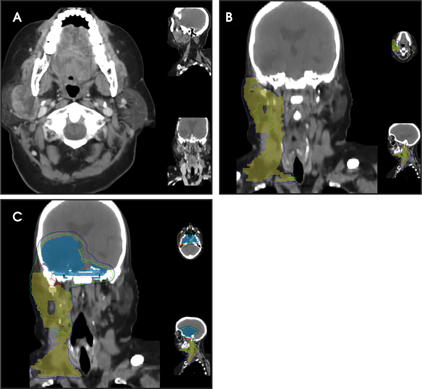 FIGURE 4.