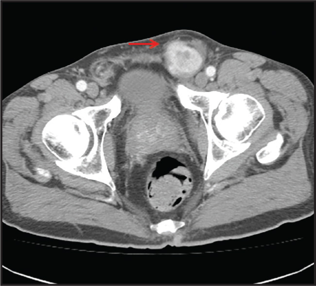 FIGURE 1.