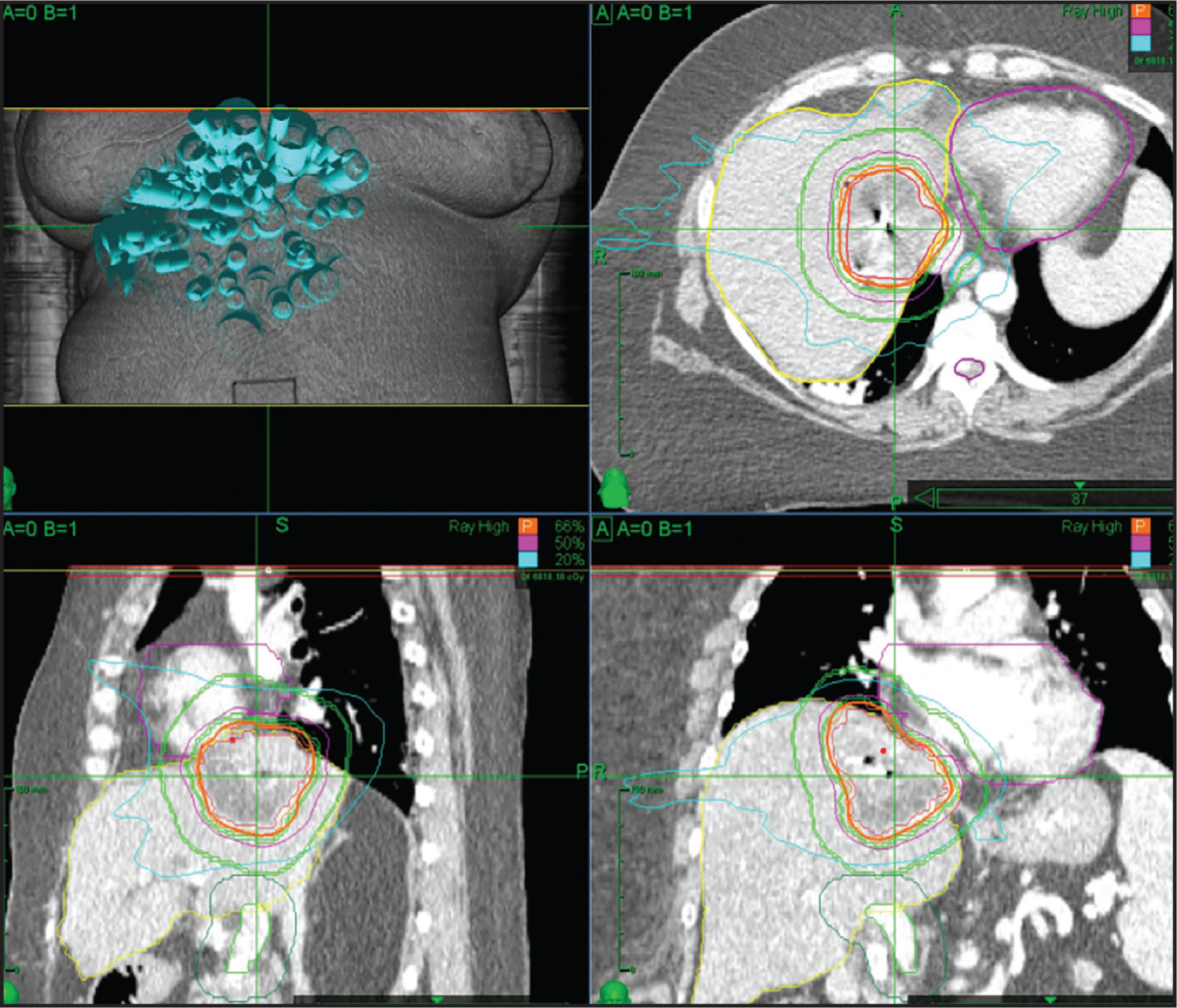 FIGURE 4.