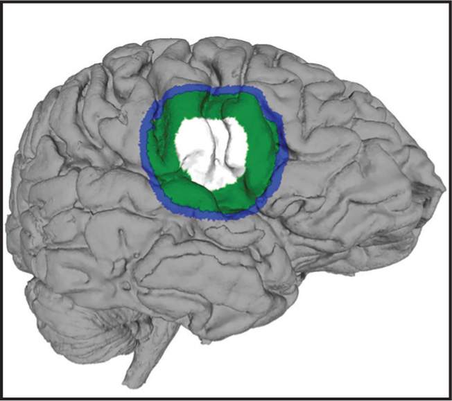 FIGURE 1.