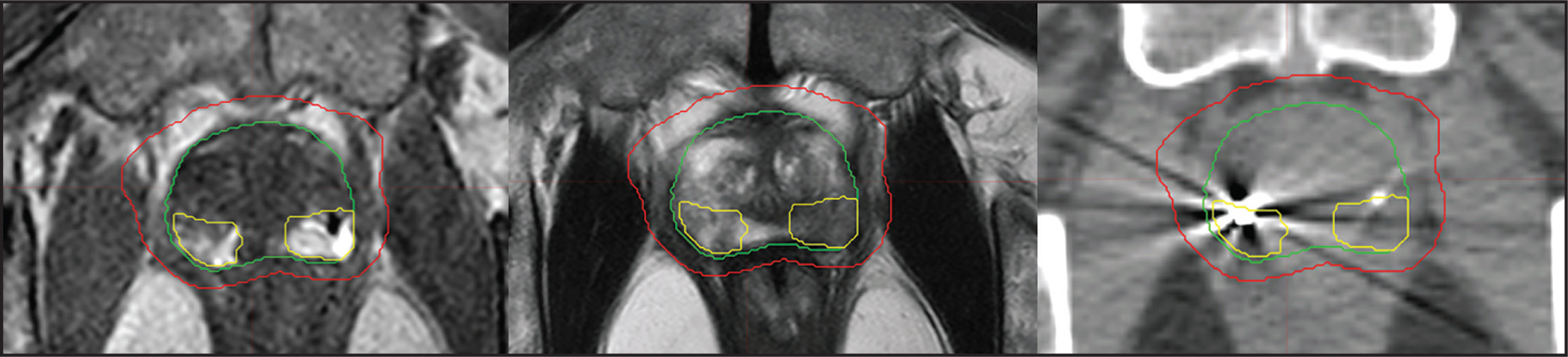 FIGURE 1.