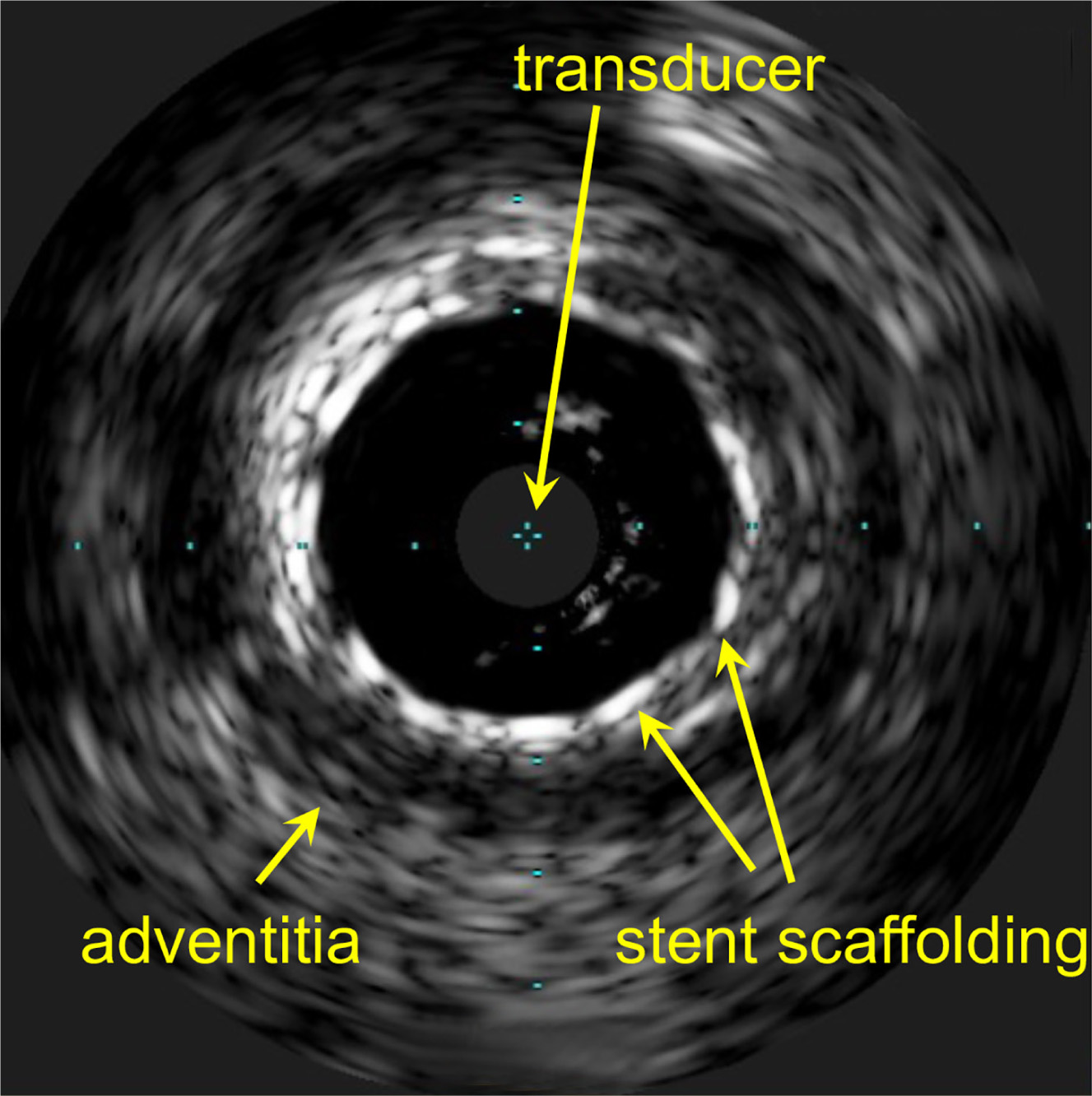 Figure 3.