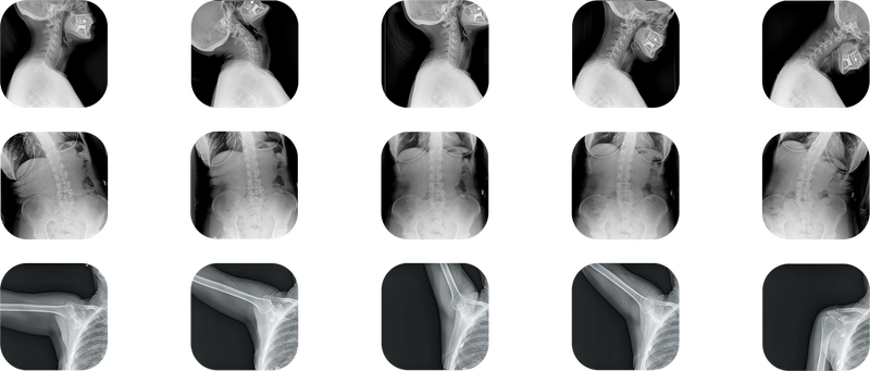 Dynamic Digital Radiography Receives FDA Clearance on Chiropractic Straight Arm