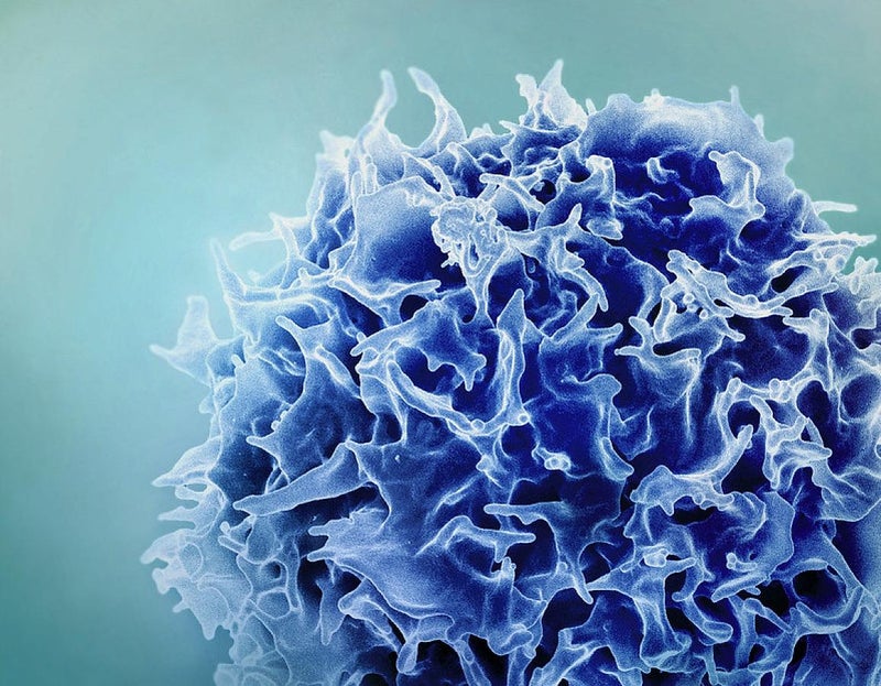 NIH Grant to Fund Research on Targeted Therapy for p53 Wild-Type Sarcomas