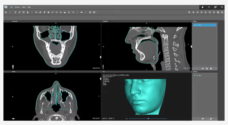 3D Systems Introduces Solution to Create Patient-Specific Radiotherapy Treatment Accessories