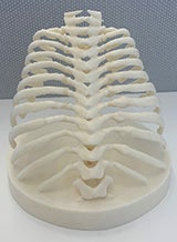 3D printed models can help radiologists testifying in child abuse cases