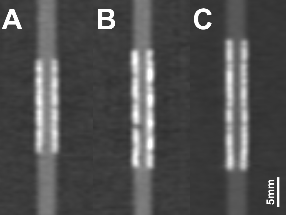 Fourth update on CTA of 24 novel coronary stents