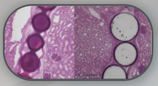 FDA Clears ABK Biomedical’s Embolic Microspheres for AVMs and Hypervascular Tumors