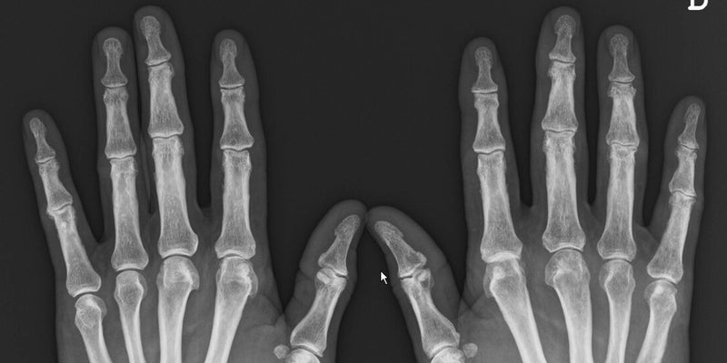 AI Bot Passes UK Radiology Exam