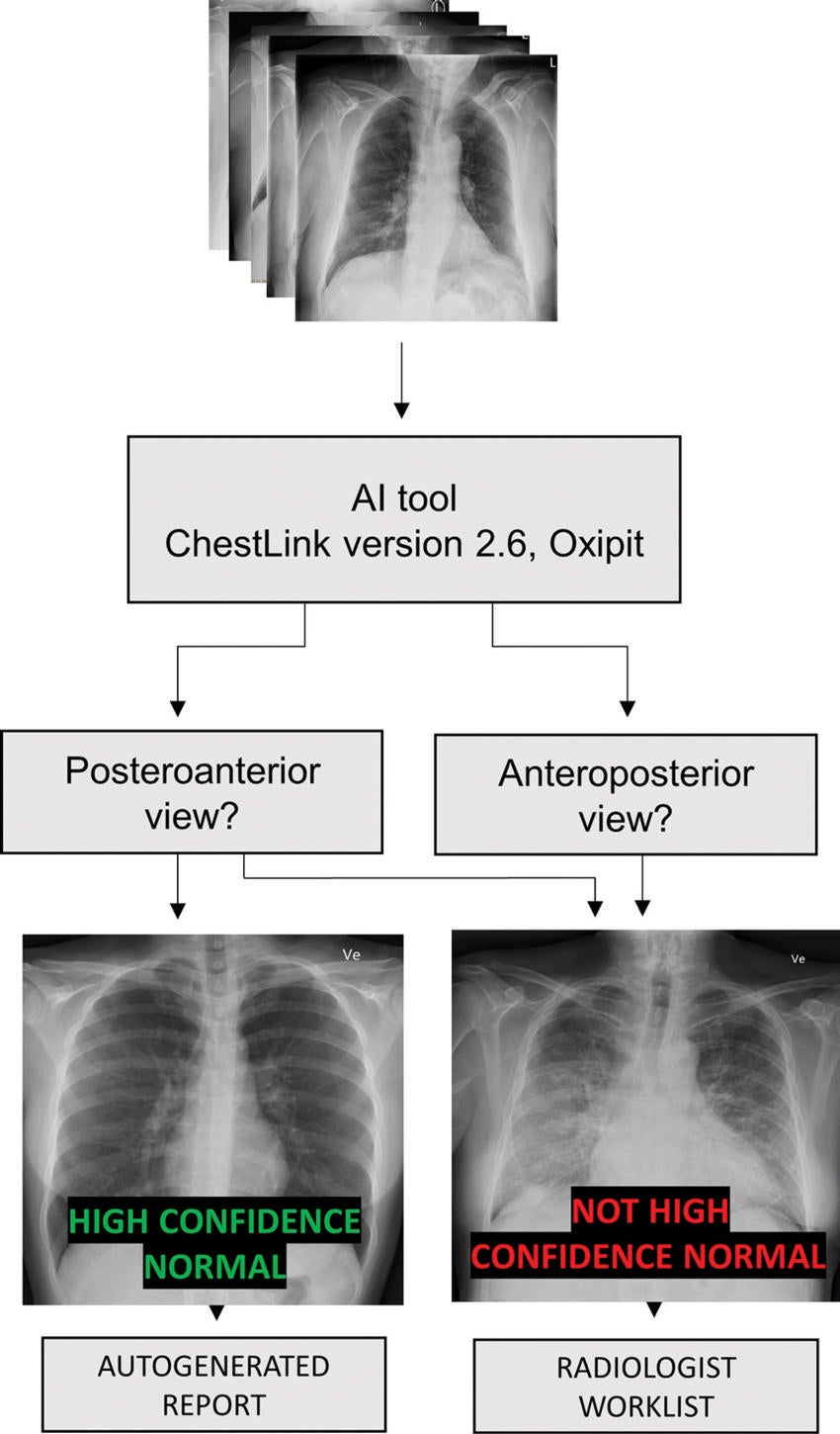 AI Tool Accurately Identifies Abnormal, Normal Chest X-rays