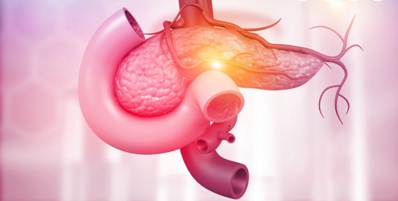 Liquid Biopsy Shows Promise for Early Pancreatic Cancer Detection