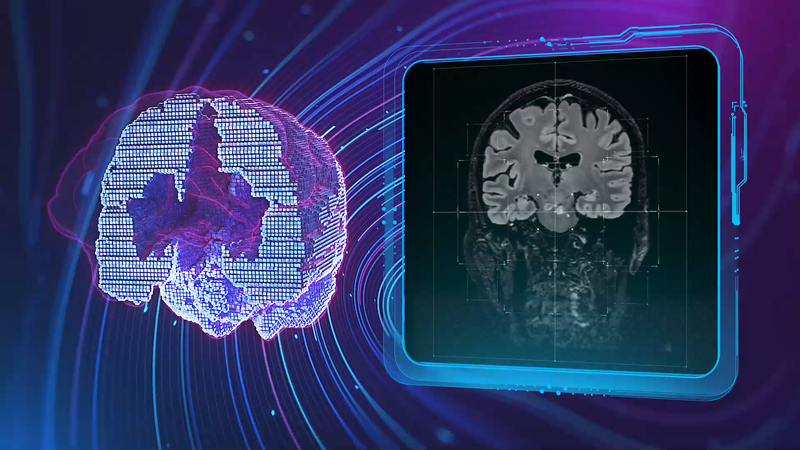 FDA Clears GE Healthcare’s AIR Recon DL for 3D and Motion-Insensitive Imaging Applications