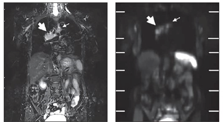Guerbet, Bracco to Collaborate on Next Generation MRI Contrast