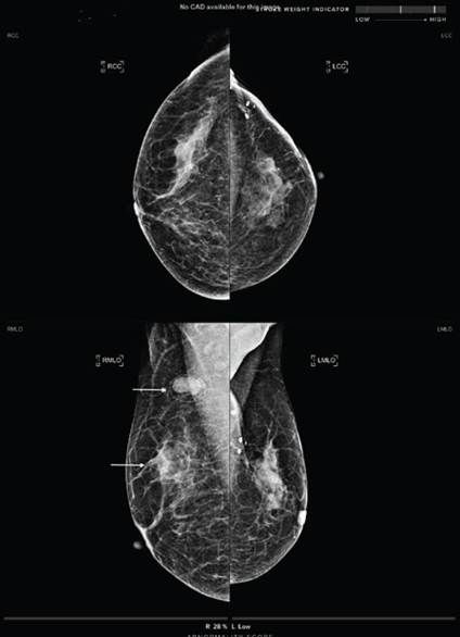 AI Reduces DBT Workload by Identifying Normal Scans
